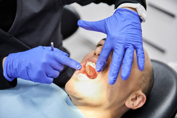 Best Dentist for Dental Trauma  in Westfield Center, OH
